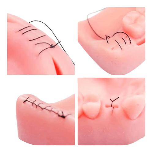 Suport sutura dentara, Suture Expert